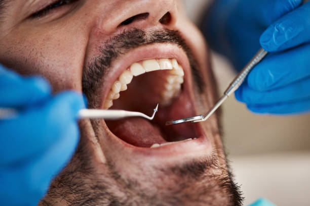 Best 24-Hour Emergency Dental Care in Stro Valley, CA