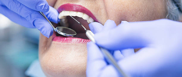 Best Emergency Root Canal Therapy in Stro Valley, CA